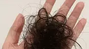 频繁掉发剃光头养发？有人真这么干，医生直摇头
