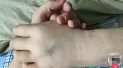 山东13岁李梦晨去世，移植一月不到，母亲痛哭孩子最后饿肚子走的