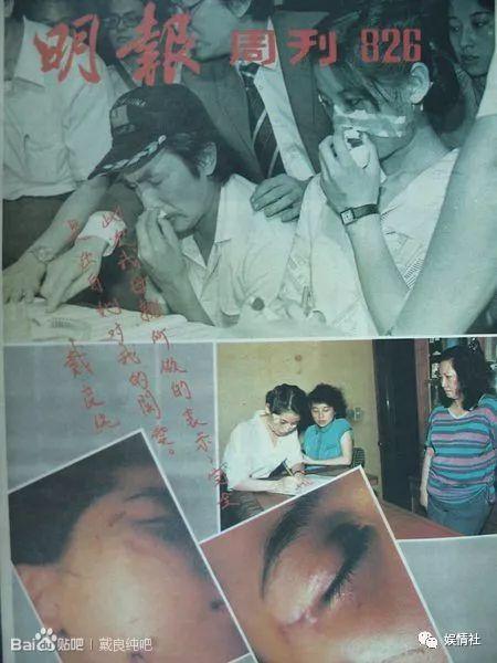 美貌过人却遭毁容，三任丈夫一死一判刑一潜逃，被疑杀夫销声匿迹