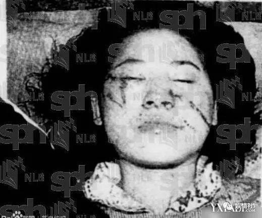 美貌过人却遭毁容，三任丈夫一死一判刑一潜逃，被疑杀夫销声匿迹