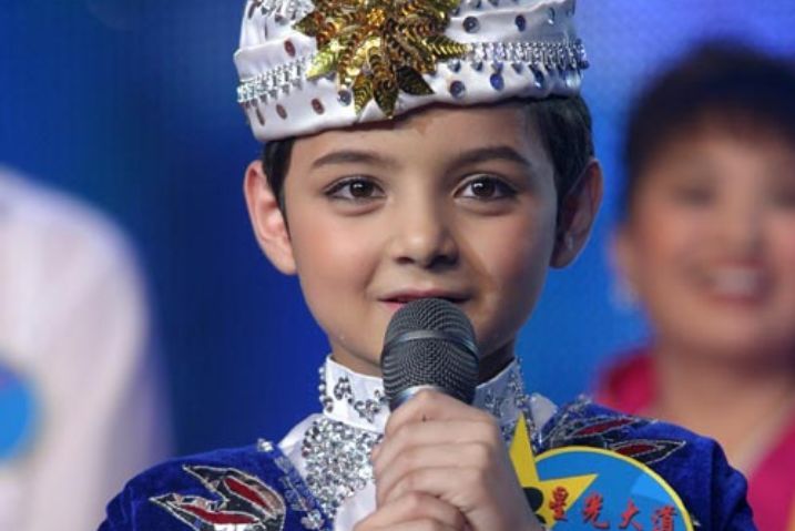 有种"整容"叫阿尔法植发,曾20岁像40岁大叔,植发后帅到不敢认