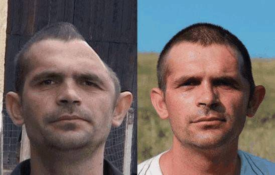 只有半个脑袋也能存活盘点真实存在的半脑人