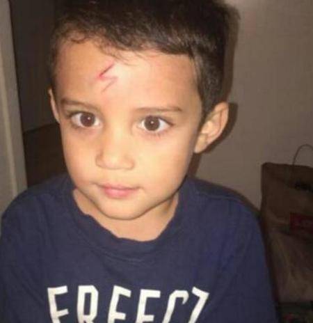 小男孩额头上有一条伤疤妈妈画了两笔之后成学校大红人